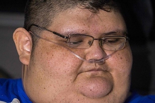 Самый толстый мужчина в мире похудел на 170 килограммов – Видео