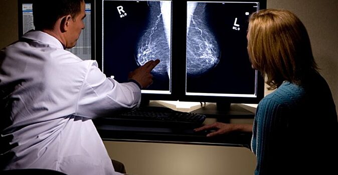 В Ивановской области выявляют 600 женщин с раком груди ежегодно