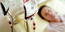 Раскрыт способ омоложения мозга переливанием крови