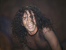 Леонтьев рискует лишиться мимики из-за пластических операции