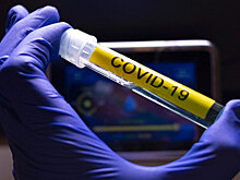 Более 21 тысячи заражений выявлено за последние сутки в РФ