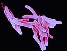 Предложен новый метод борьбы с туберкулезной палочкой
