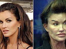 Знаменитости, пожалевшие о том, что сделали пластику