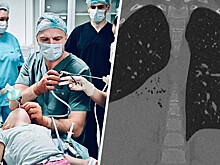 Из легкого ребенка достали колпачок от ручки