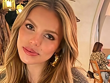 Популярная модель показала внешность после удаления филлеров из губ