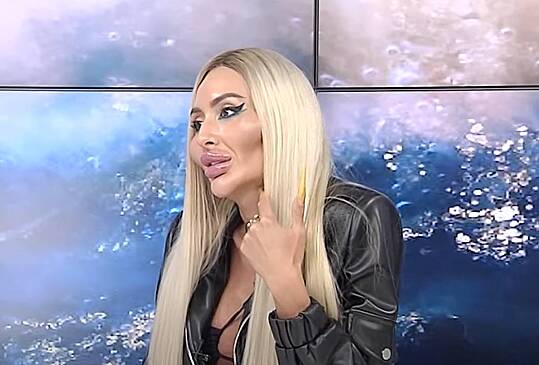 Украинка с самыми большими щеками показала фото в одних трусах
