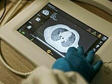 В комитете Совфеда высказались за расширение новых технологий в здравоохранении