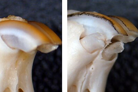 Ученые нашли способ восстановить потерянные коренные зубы