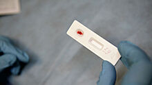 Охват тестирования на ВИЧ ежегодно увеличивается на два миллиона