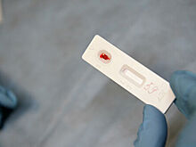 Охват тестирования на ВИЧ ежегодно увеличивается на два миллиона