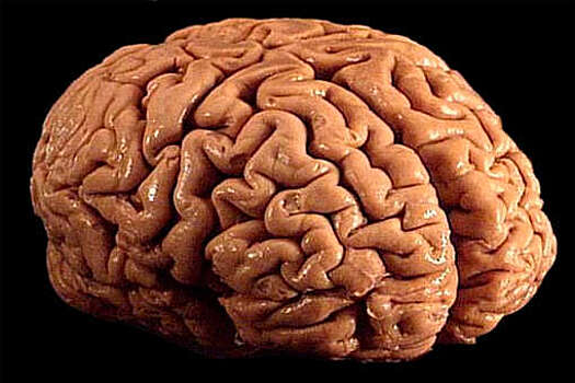 Биологи выявили причину чрезмерного складывания мозговых извилин