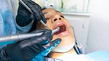 Стоматолог предупредила об опасности игнорирования зубной боли