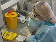 Реже умирать от рака в год пандемии COVID-19 стали жители Новосибирской области