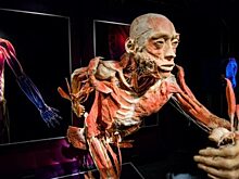 6 самых шокирующих анатомических музеев мира