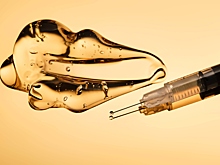 Помогают ли похудеть уколы ботокса в ушные раковины