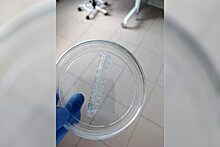 Рязанские ученые изобрели искусственные сосуды из клеток пациента