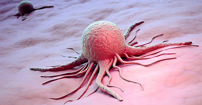 «РГ»: ученые нашли опасный симптом, возникающий за 2 года до агрессивного рака