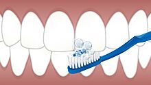 Стоматолог заявил о неэффективности разрекламированных зубных паст из масс-маркета