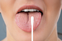 Почему опасны белые пятна во рту