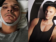 Композитор Аллы Пугачевой попал в ДТП