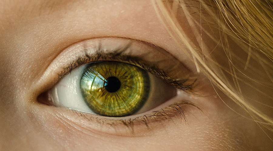 О чем сигнализируют бляшки вокруг глаз