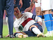 Сестра Роналду о его разбитом носе в матче с Чехией: «Проливает кровь во имя любви к футболке»