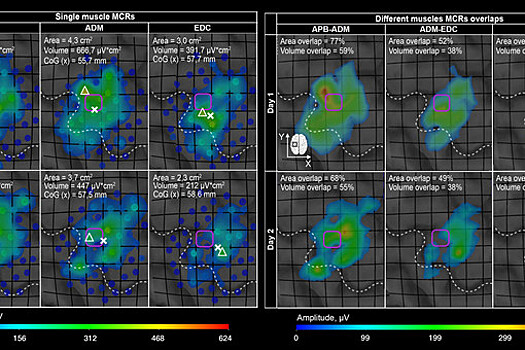 Магнитные импульсы помогли создать диагностические карты активности мышц