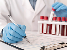 Нужно ли снижать холестерин, если он высокий