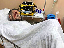 Мосийчук: пытаюсь вернуться к жизни