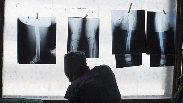 Откуда берется ревматизм и как он меняет жизнь