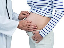 Беременность без проблем: как выявить и вылечить опухоль яичника