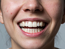 Стоматолог vs дерматолог: кто на самом деле лечит ваши прыщи