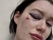 Россиянин бросил телефон в глаз жене во время ссоры и избежал наказания