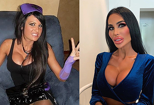 Зависимая от пластики девушка 5 раз увеличила грудь