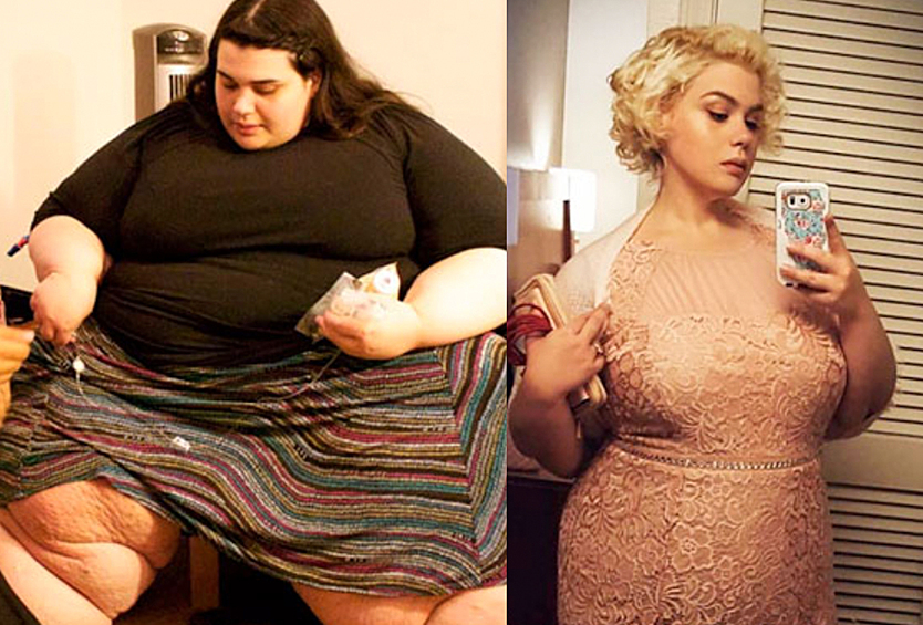 Девочка с лишним весом. Из толстушки в анорексичку. Худые которые стали толстыми. Похудение до и после. Худые которые стали толстыми.