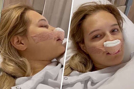 Дочь Екатерины Климовой перенесла операцию на нос