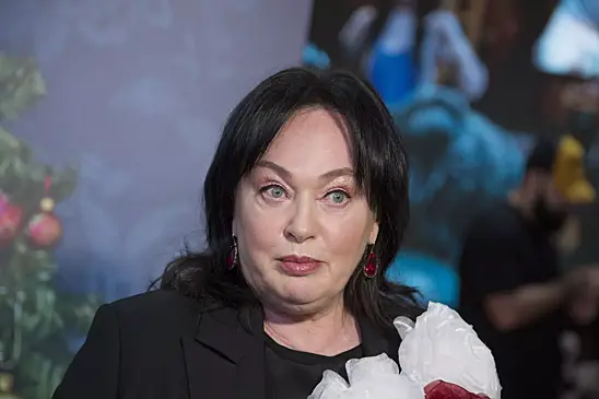 Хирург считает, что Гузеева делала подтяжку лица и блефаропластику