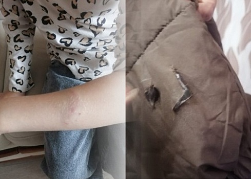 Начата проверка после инцидента с нападением собаки на школьницу в Искитиме