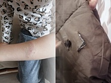 Начата проверка после инцидента с нападением собаки на школьницу в Искитиме