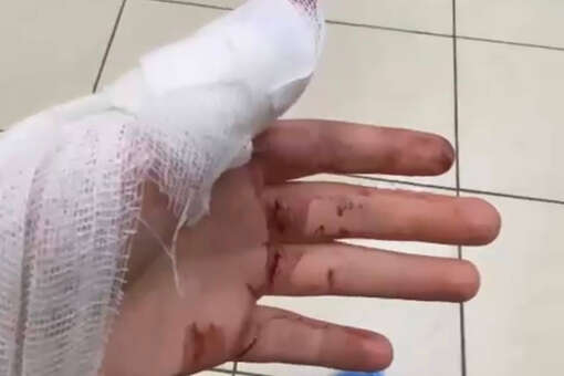 В Петербурге школьник отрубил себе палец на уроке труда