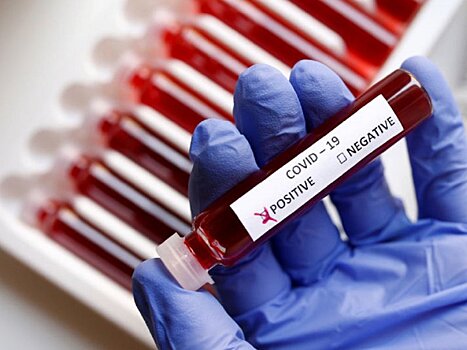 В Оренбуржье рекордное количество заболевших COVID-19 – 293 человека