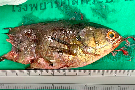 Рыба-ползун заползла в горло ребенку и застряла