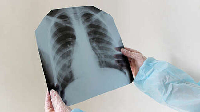 СК занялся гимназией в Южно-Сахалинске после случая туберкулеза