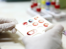 Анализ крови помог выявить биполярное расстройство