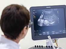 В Подмосковье запретили склонять женщин к абортам