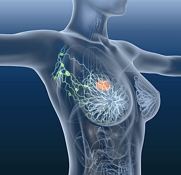 Учёные нашли в женском организме гены, защищающие от рака груди