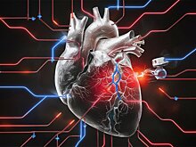 В России создадут стандарты для кардиостимуляторов