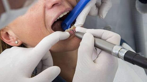 Стоматологи назвали главные продукты-"разрушители" зубов