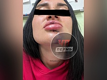 В Перми неизвестный избил девушку в клубе и сломал ей зубы