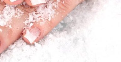 Зимние советы — как быстро восстановить обветренную кожу рук